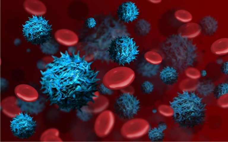 Akut miyeloid lösemi tedavi edilebilen bir hastalıktır
