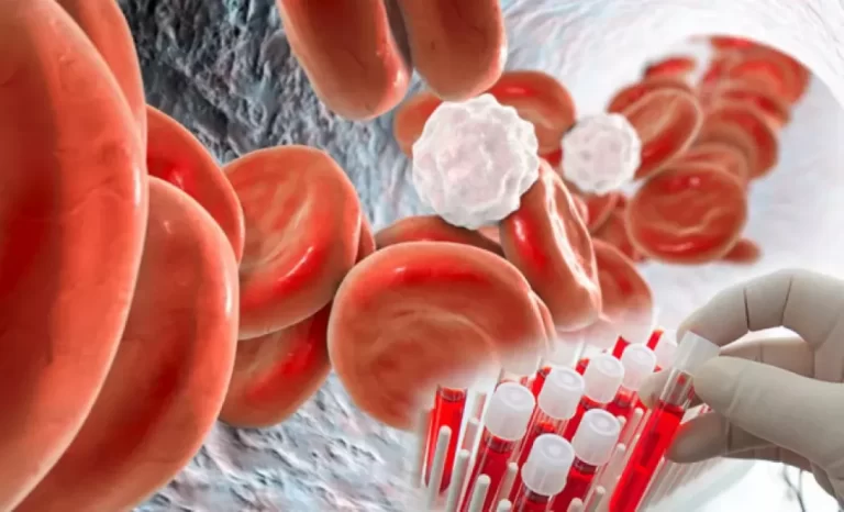 Araştırma I A grubu kana sahip olanlarda felç riski daha yüksek; O grubunda daha düşük