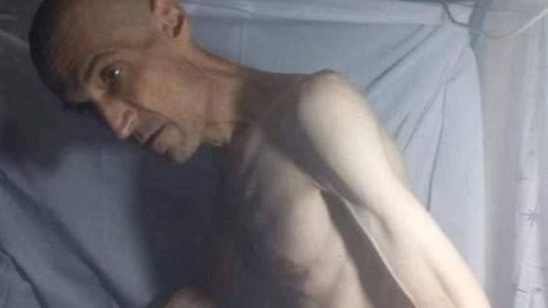 İran: Açlık grevinde bitkin düşen eylemcinin, zorunlu başörtüyle mücadelesi