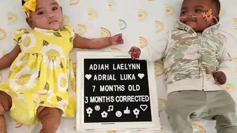 Kanada’da 22 haftalık prematüre ikiz bebekler Guinness rekorlar kitabına girdi