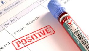 İnsan Bağışıklık Yetmezliği Virüsü (HIV) vaka sayısı Türkiye’de yaklaşık 40 bine dayandı