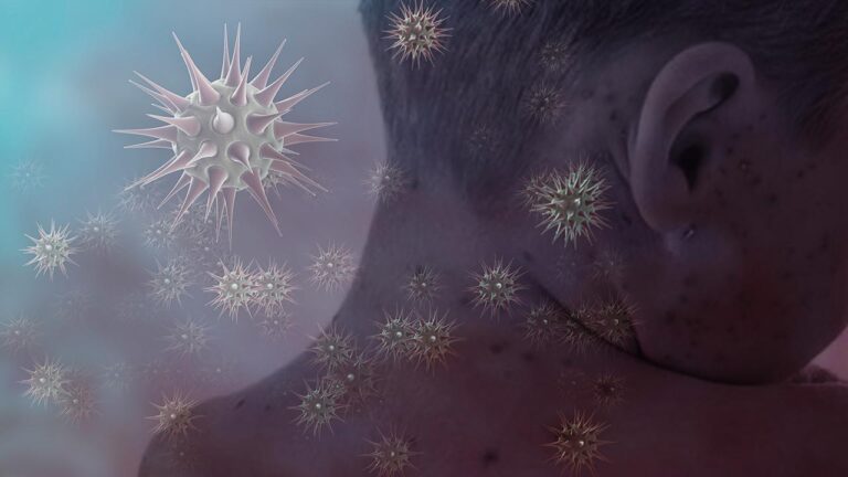 Kızamıkta en çok vaka İstanbul’da