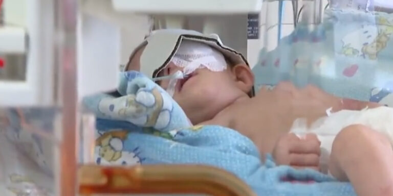 35 Günlük Hamza Bebeğin Göz Ameliyatı Ankara’da Yapıldı