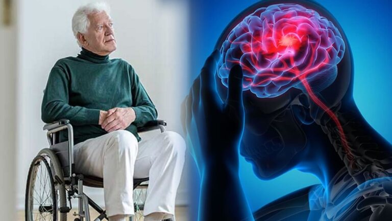 İnme, ölüm nedeni olarak üçüncü, sakatlık oluşturan hastalıklar arasında birinci sırada yer alıyor