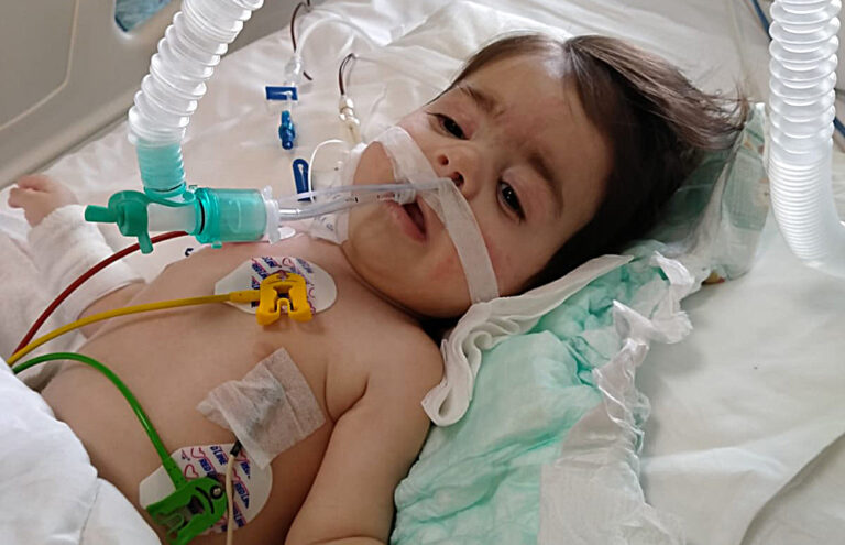 SMA’lı hastalar için “gen terapisi” çalışmaları