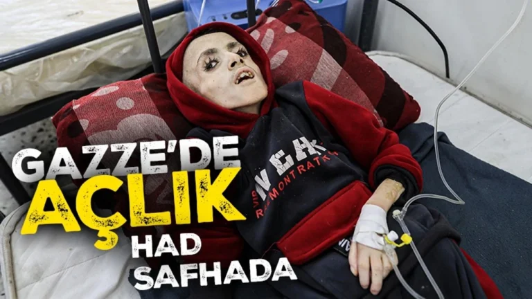 Gazze’de açlık ve susuzluk kol geziyor…