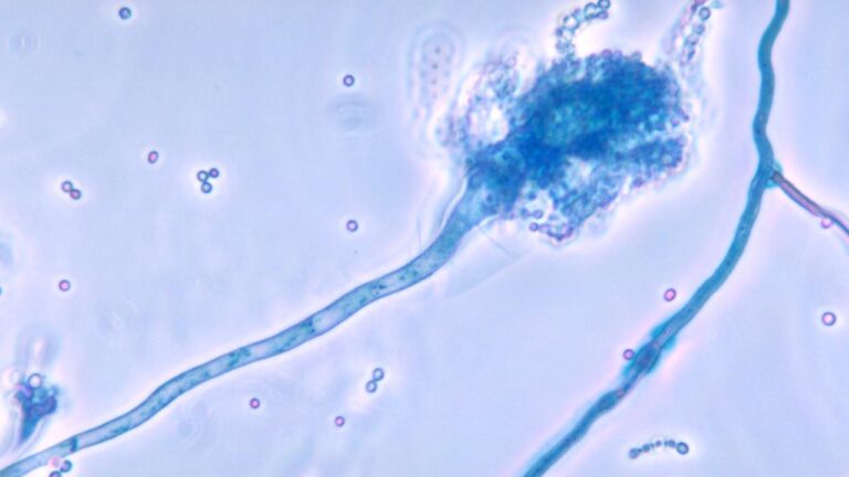 Yeni bir araştırma, sıcak bölgelerde yaygın olan ölümcül mantar hastalığının küresel ısınmayla yayılabileceğini ortaya koydu…