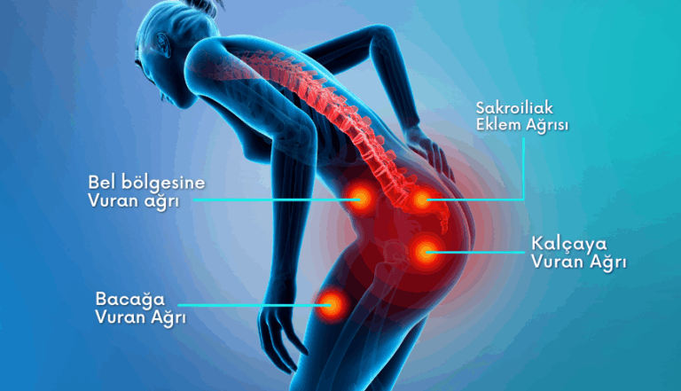 Bel ve kalçada sabah tutukluğu varsa dikkat!