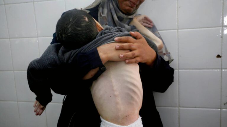 BM Gazze’de tam kıtlık hali ilan etti