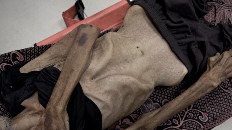 Soykırımın yeni yüzü: Kıtlık